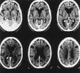 Brain Imaging & Beyond