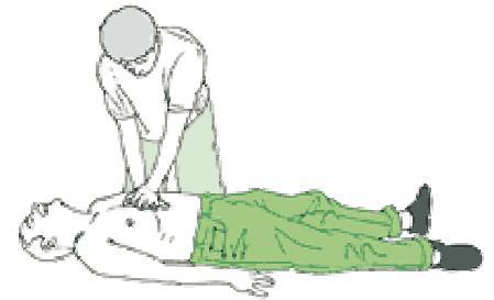 if breathing starts, place in recovery position; if the chest fails to rise during inflation, the airways are blocked; external cardiac compression must not be carried out until the airways are