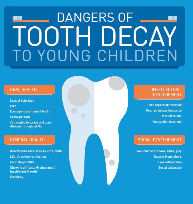 DENTAL HEALTH Tooth decay is the single most common chronic childhood disease. 1 By age 5, approximately 60% of US children will have had caries.