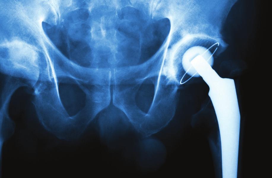 CORE CERTIFICATIONS Core Hip and Core Knee Replacement Certifications Orthopedic joint replacement programs