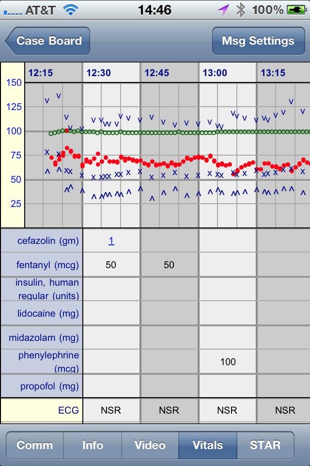 Figure 3 - Graphical Vital Signs View (left) the top grid represents blood pressure, oxygen saturation, and pulse values collected directly from the physiologic monitor.
