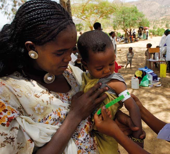 Acute malnutrition UNICEF, 2008 Suggested New Design Framework for CMAM Programming Original article by Peter Hailey and Daniel Tewoldeberha Source: FEX 39, p41 http://www.ennonline.