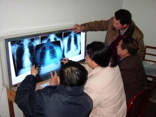 Preliminary screening of chest X-ray films All chest X-ray films