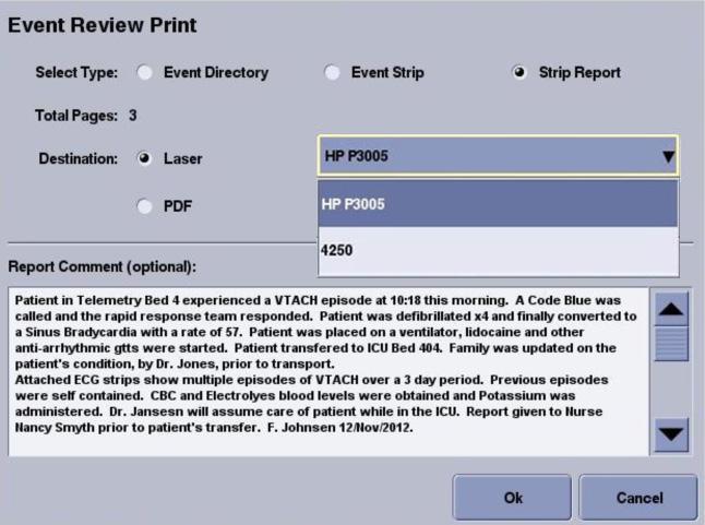 Strip reporting allows users to flag ECG strips electronically, eliminating manual paper strip cutting and gluing. Reports can be printed for the patient s chart.