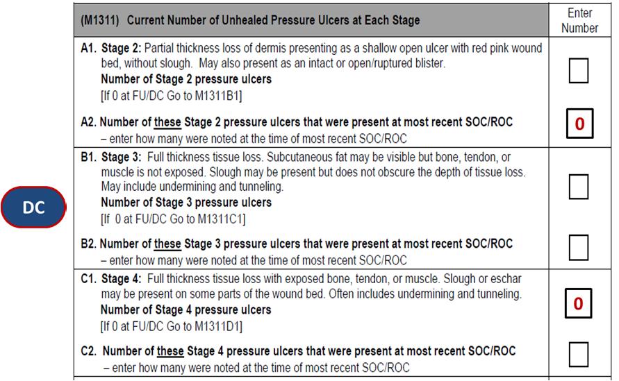 1 If a pressure ulcer was unstageable at SOC/ROC, but becomes numerically stageable later, when completing the Discharge, its Present