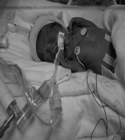 Early interventions to improve neurodevelopmental outcomes of premature infants Leonora Hendson Northern Alberta Neonatal Intensive Care Program Neonatal and Infant