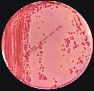 false negative Red pigment in urine false