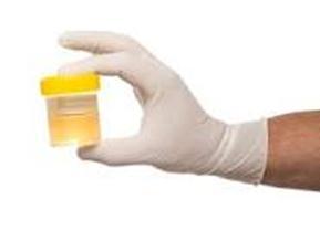 Collecting a proper specimen Urine specimen collection should be done in a manner that minimizes contamination Non-catheterized resident: 2 Acceptable Methods only!