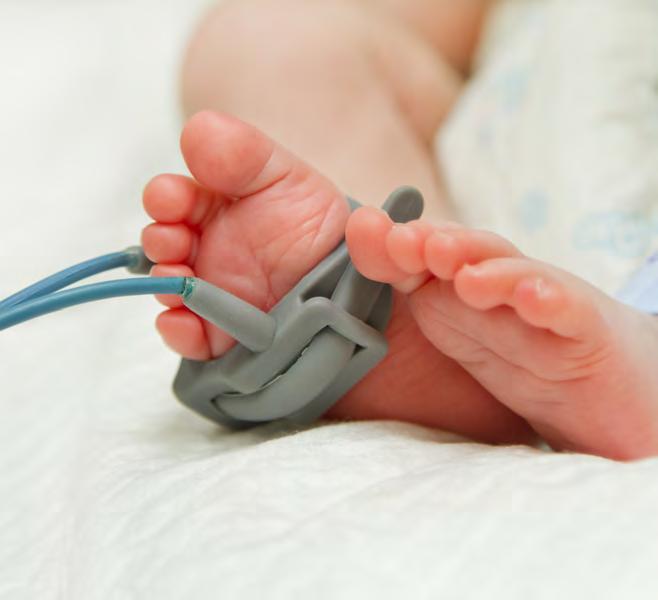 WHAT IS NEONATAL ABSTINENCE SYNDROME (NAS)? In 2014, the number of babies born with NAS in Tennessee reached 973, a 5.
