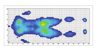METHODS A descriptive study comparing pressure distribution at different body locations at four discrete positions in bed was conducted in the lab of Evan Call MS, CSM of Weber State University,