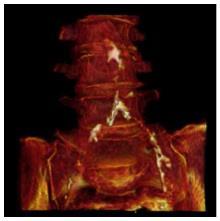 Mummy CT scans show
