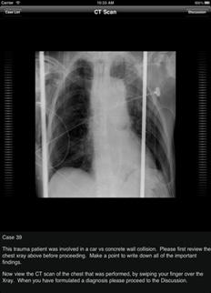94 Exploring PDA Usage by Iranian Residents and Interns Figure 2 Lexi-drugs calculator on a handheld device [12] Figure 3 A radiology application shows a CT scan of the chest of a trauma patient [13]