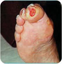 osis of a skin ulcer/wound, the clinician is expected to document the clinical basis (e.g.