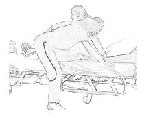 The orthodox lift Two-sling lift - (not shown) with slings placed under the patient s lower back and thighs, the handlers stand either side of the patient with one knee