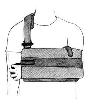 Section V: Activity Activities of Daily Living Personal Care Shoulder Immobilizer with an Abduction Pillow The shoulder immobilizer with an abduction pillow is a type of sling that your surgeon may