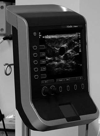 Safe Practice Guideline: Real-time ultrasound guidance will be