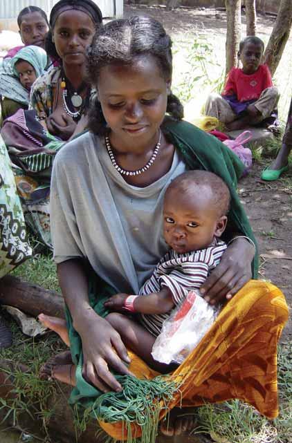 OTP Treatment for severely malnourished children consisted of a weekly health check, provision of a RUTF ration according to weight, standard medical treatment, and basic nutrition education for