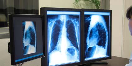 Improving access to care Diagnostic imaging across Canada Improves radiologist productivity up to 30% Nearly 40% of radiologists use remote reporting to deliver