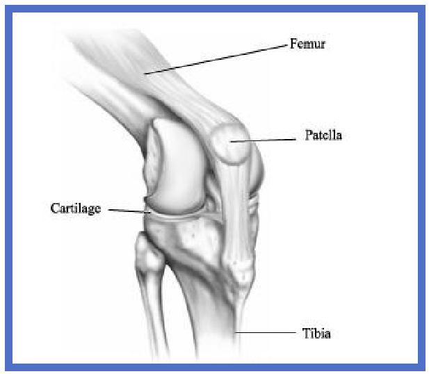 Why Do I need My Knee Replaced? Most people have a knee replacement because the padding (cartilage) between the bones has worn away and the bones are rubbing against each other.