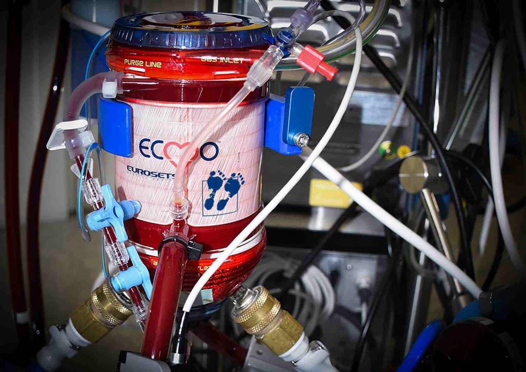 ECMO AND