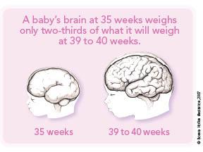 Timing of Fetal Brain Development Cortex volume increases by 50% between 34 and 40 weeks gestation.