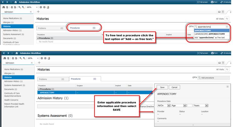 Admission Workflow mpages Histories Component (Problems/Procedures) Procedures will not pull in from outside records.