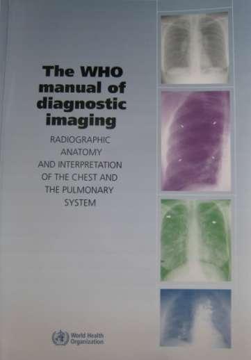 Radiographic anatomy and interpretation of the chest and the pulmonary system (ISBN 92 4 154677 8) The WHO Lecture Series on Radiology and