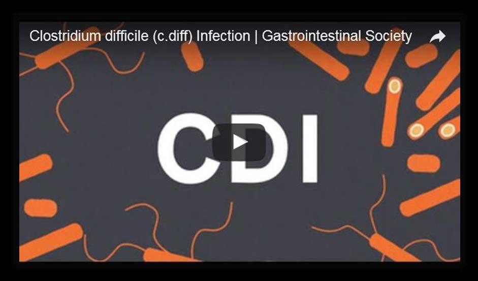 CDI Video titled Clostridium difficile Video, produced by the Canadian Society of Intestinal Research: GI Society (6:24) provides an overview of