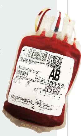 Serious Adverse Events (SAEs) in Blood Transfusion