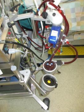 Data 2015 139 patients with an ECMO/ECLS procedure were cared for in the intensive care unit at the University Hospital Zurich last