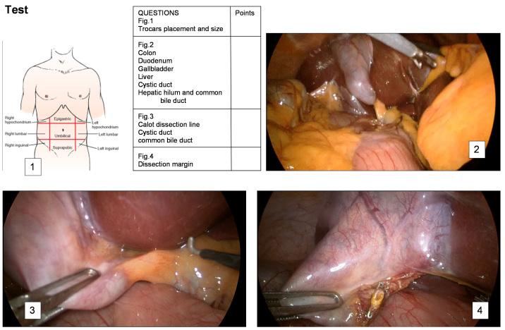 Development of a model for laparoscopic cholecystectomy video assisted training.