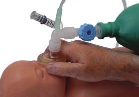 Essential respiratory mechanics are captured and displayed by the Engström Carestation software, specifically designed for the unique parameters of the infant.