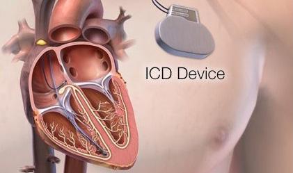 What is Implantable Cardioverter Defibrillator (ICD) deactivation? There may come a time when you no longer want to receive shocks to prevent sudden cardiac death.