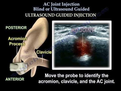 Injections with Ultrasound Guidance: 20611 Copyright Copyright 2016 CHLM. 2016 CHLM. All rights All rights reserved.