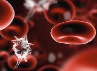 Sepsis Blood poisoning or septicaemia Can affect all age groups Bigger killer than myocardial infarction (MI), stroke, COPD or chronic lung cancer The total number of patients