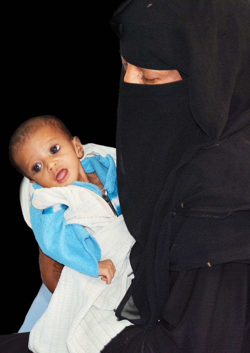 Zahraa s story 29 Three-month-old Zahraa was admitted to a WHO-supported therapeutic feeding centre at Al-Thawra Hospital in Hudaydah governorate suffering from severe acute