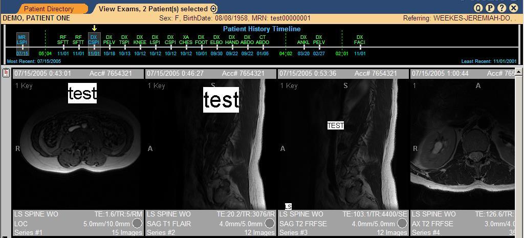 Click the plus (+) sign next to the patient to display studies. 4. Double click the study to display. 3 2 1 000000002 4 Patient Directory: Return to the main screen to look up another patient.