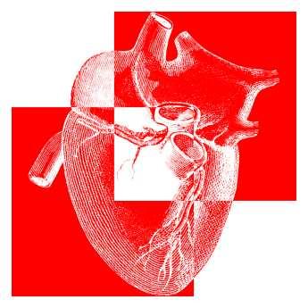 What s happening in Cardiac Registries in Australia?
