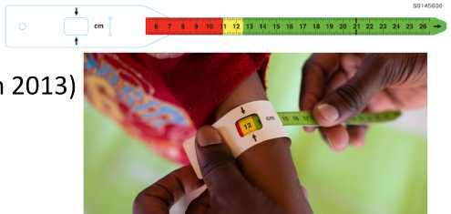 Assessing for acute malnutrition in sick children aged below 5 years Assessment of acute malnutrition (from 2013) Mid Upper Arm Circumference OR Weight/height (length) Z score +/-Edema of kwashiorkor