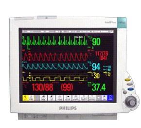 Detecting state at the bedside: what needs to be done Physiologic time series Heart (EKG) Vasculature