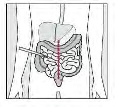 This is where the fluid is absorbed from the food and stool is formed (your bowel movement). The stool is then stored in your rectum, until it is passed out of your body through the anus.