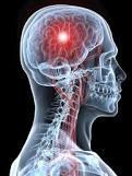Stroke Burden Every 4 minutes, someone dies of a stroke Each year, about 795,000 people in the U.S. have a stroke Stroke is the fourth leading cause of death in the U.S. for both men and women 1 in every 18 deaths in the U.