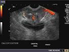 Ultrasound renal/ scrotal