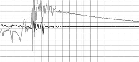 Output signals from each sensor are measured for 10 seconds, and measurements are taken 20 times for each normal walking, syncope, and convulsion state respectively.