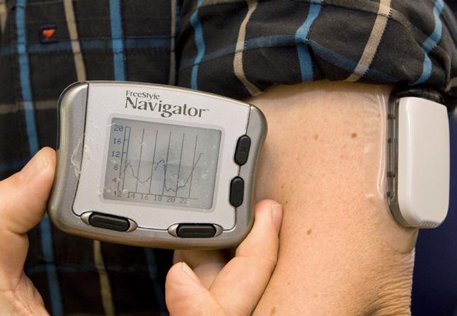 Diabetes process results in fewer complications for the patient and use of cutting-edge technology The diabetes process has developed guidelines for diagnosis, expanded the use of cutting-edge