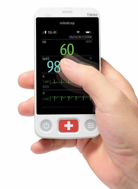 Expandable Capabilities When the need arises, begin monitoring your patient s blood pressure with the portable BeneVision BP10 NIBP Module.