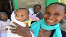 6 Free to Smile Free to Smile Cleft Lip and Palate Report Latest news: We have raised $19,815 with the matching campaign.