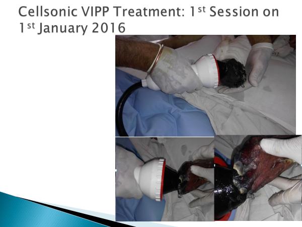 before cellsonic VIPP treatment Figure 2.