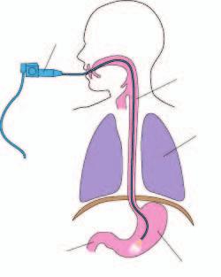 Easy Read 2 Gastroscope Duodenum Oesophagus (gullet) Lungs Stomach A gastroscopy is a test that checks if your tummy is