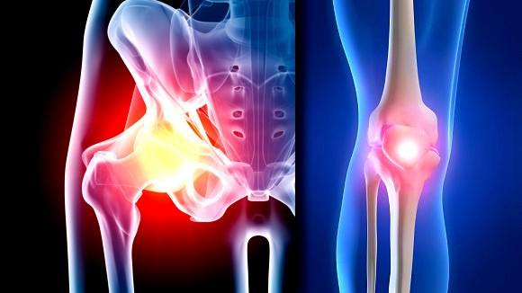 OSTEOARTHRITIS & HIP AND KNEE REPLACEMENT with Rob Middleton & Tom Wainwright ABOUT KEY TOPICS This multi-disciplinary, one-day master-class will help you to implement best practice and effectively